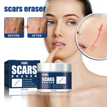 EELHOE Scar Balm, Surgery Scar Repair Cold Compress Scar Skin Scar Gel Balm