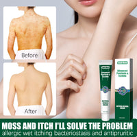 Wet Search Herbal Cream, Skin Cream Moisturizes, Hydrates And Reduces Itching Herbal Cream