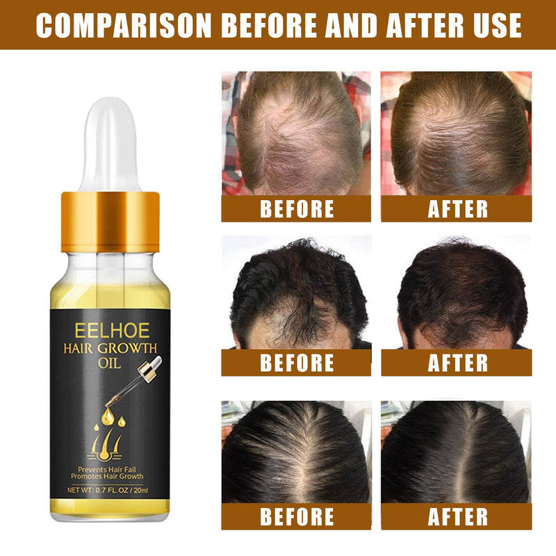 EELHOE Hair Growth Oil, Strengthens And Strengthens Hair Essential Oil Softens And Moisturizes Hair And Thickens Hair Nutrient Solution