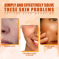 EELHOE Vitamin C Moisturizing Spray Hydrates And Moisturizes Skin, Lightening Acne Spots And Whitening Spray