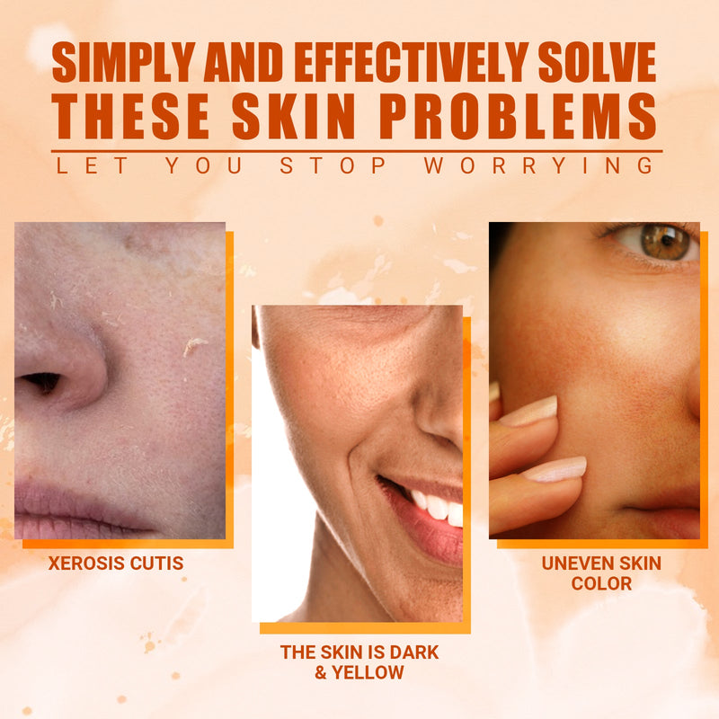 EELHOE Vitamin C Moisturizing Spray Hydrates And Moisturizes Skin, Lightening Acne Spots And Whitening Spray