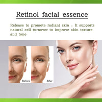 OUHOE Retinol Serum, Face Anti-Wrinkle Firming Brightening Soft And Smooth Skin Serum