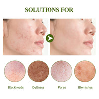 Blackhead Removing Serum Suit, Clean Pores Fine Oil Control Clean Repair Acne Blackhead Nose Patch