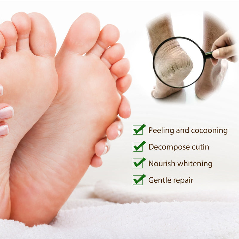 West&Month Nut Oil Foot Mask, Niacinamide Foot Mask Exfoliates Dead Skin Moisturizing And Repairing Foot Mask