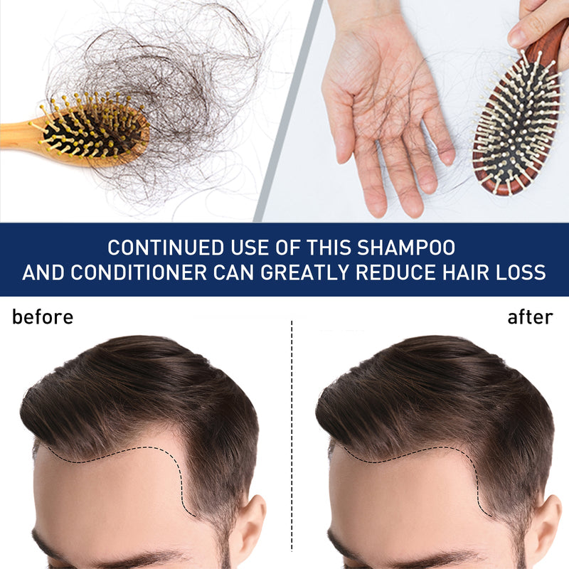 Alopecias Hair Growth Cream, Scalp Deep Nutrition Hair Repair Hair Follicle Rejuvenating Gloss Brightening Cream