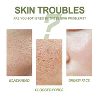 Blackhead Removing Serum Suit, Clean Pores Fine Oil Control Clean Repair Acne Blackhead Nose Patch