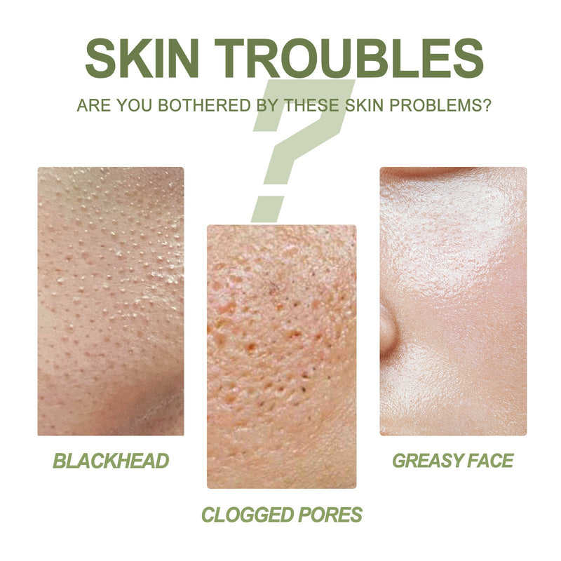 Blackhead Removing Serum Suit, Clean Pores Fine Oil Control Clean Repair Acne Blackhead Nose Patch