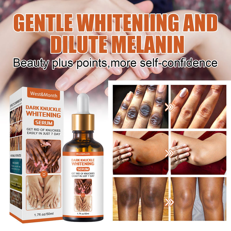 Skin Blackening Essence Brightening Knee Ankle Horn Melanin Removing Moisturizing Essence