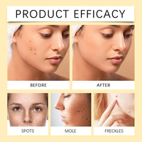 Flaw Free Skin Anti-Freckle Serum, Brightening And Moisturizing Essence For Refreshing And Cleansing Skin