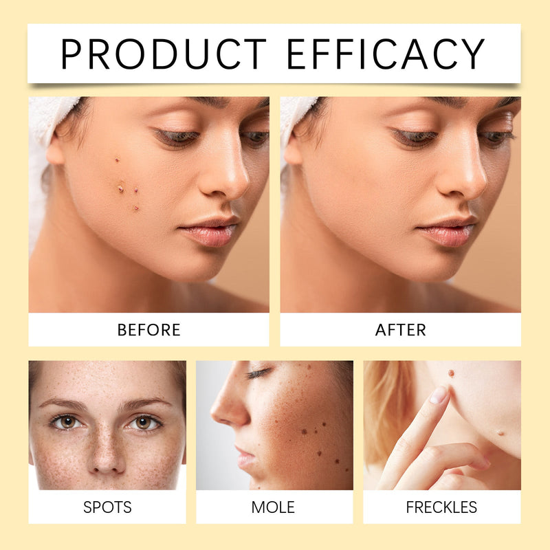 Flaw Free Skin Anti-Freckle Serum, Brightening And Moisturizing Essence For Refreshing And Cleansing Skin