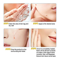 EELHOE Wart Essence Removes Dark Moles Flesh Moles Repair Skin Neck Flesh Grains Flat Especially Corns Remove Warts
