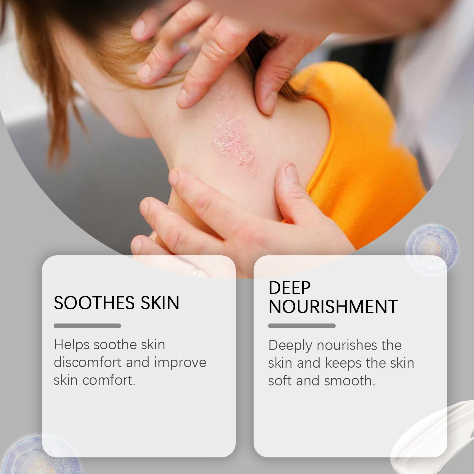 Moss Beesvenom Care Cream Relieves Itchy Skin With Moss Moisturizing Skin Care Cream