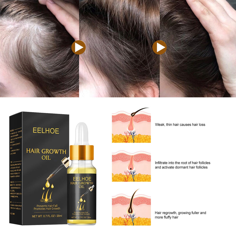 Hair Growth Oil, Strengthens And Strengthens Hair Essential Oil Softens And Moisturizes Hair And Thickens Hair Nutrient Solution
