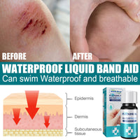 Breathable Surface Liquid Dressing, Protective Waterproof Transparent Wound Dressing Fast Film Formation