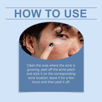 Moon Acne Patch Repair Acne Skin Breathable Facial Skin Gentle Cleansing Patch