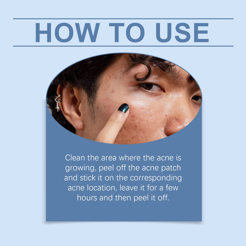 OUHOE Acne Patch - Breathable Gentle Cleansing Facial Repair Care