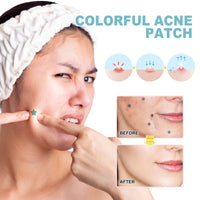 Colorful Acne Patch, Gently Cleanse And Repair Acne Facial Impurity Care Patch