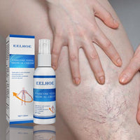 EELHOE Intravenous Massage Spray For Varicose Veins Relief And Earthworm Leg Blood Vessel Bulge Pain Spray