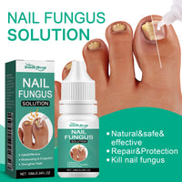 South Moon Nail Care Essence Moisturizes And Cleanses Hands, Feet And Nails And Brightening Nails Daily Care Essence