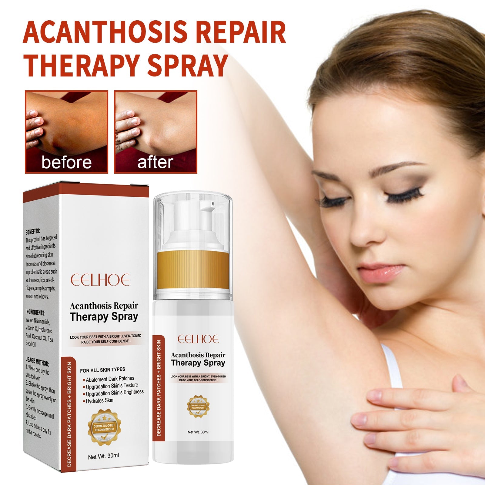 Black Acanthoderma Treatment Spray Cleanses Horny Joints Black Whitening Spray Melanin Repair Underarms