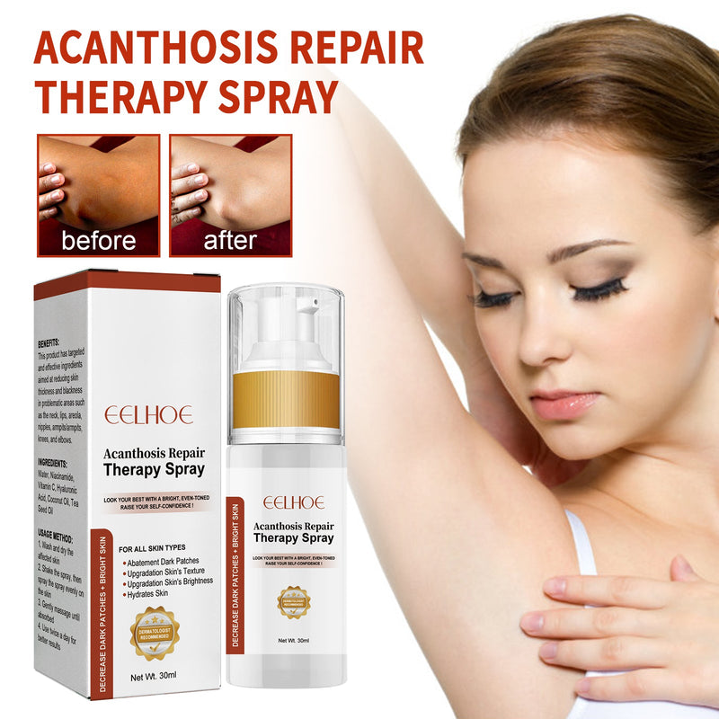 Black Acanthoderma Treatment Spray Cleanses Horny Joints Black Whitening Spray Melanin Repair Underarms