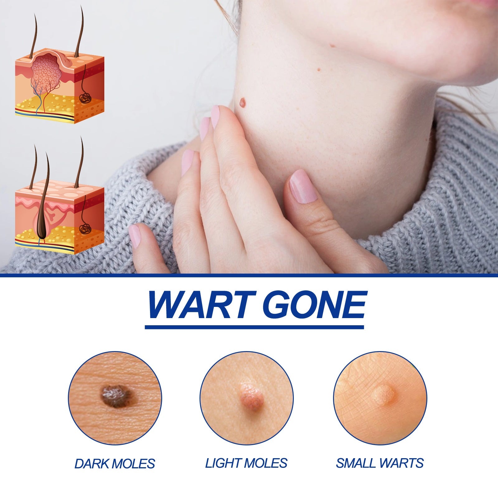 ke Wart Essence, Repair Moles, Flesh Granules, Flatness, Especially Clear Skin Body Skin Care