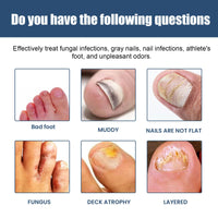 Nail Care Spray Gently Cleans Foot Nails Moisturizing And Brightening Nail Care Spray