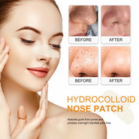 Nose Patch, Remove Blackheads Acne Pimples Deep Clean Pore Dirt Tear Nose Mask