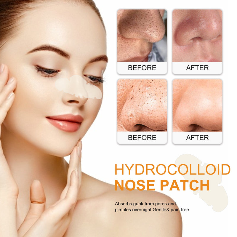 Nose Patch, Remove Blackheads Acne Pimples Deep Clean Pore Dirt Tear Nose Mask