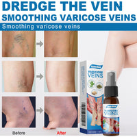 South Moon Leg Care Spray Gently Relieve Leg Discomfort, Blue Veins And Bumps Repair Daily Care
