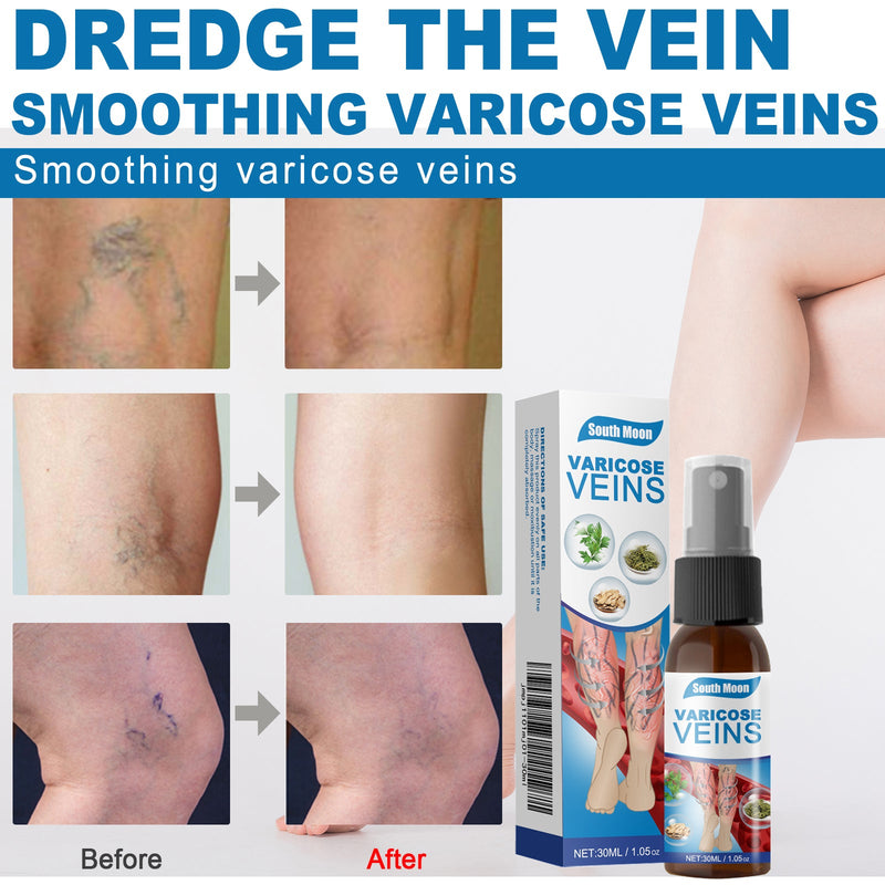 South Moon Leg Care Spray Gently Relieve Leg Discomfort, Blue Veins And Bumps Repair Daily Care