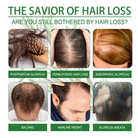 Rosemary Water, Moisturize Hair Roots Repair Damaged Hair Strengthen Hair And Prevent Hair Loss