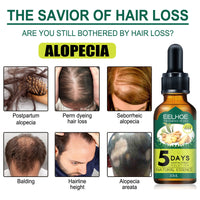 EELHOE Ginger Hair Essential Oil Moisturizes And Softens Hair And Repairs Frizzy Damaged Hair