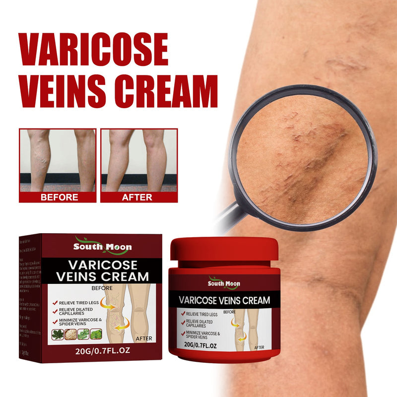 South Moon Varicose Veins Cream, Leg Massage Treatment Soreness Relief Repair Varicose Body Care Cream