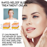 Rapid Relief Blemish Treatment Cream, Repair Dark Spots Dull Moisturizing And Brightening Beauty Cream