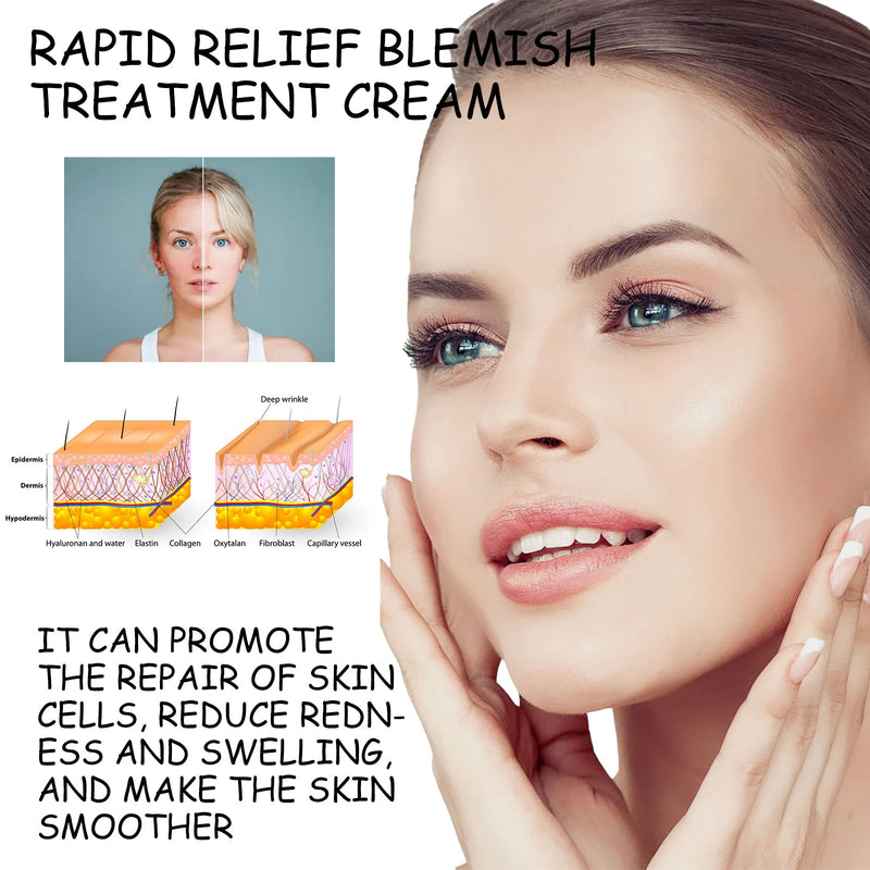 Rapid Relief Blemish Treatment Cream, Repair Dark Spots Dull Moisturizing And Brightening Beauty Cream