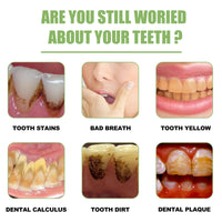 Teeth Whitening Serum To Remove Stains, Bad Breath, Whitening Teeth And Whitening Teeth