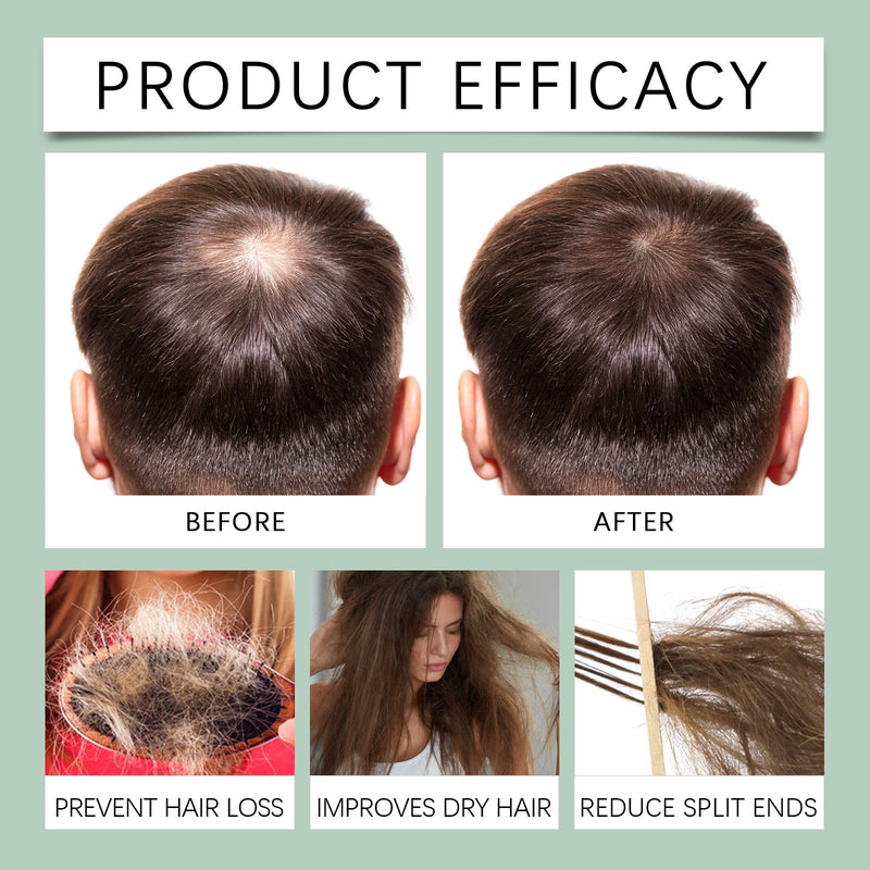 Original Rosemary Hair Spray, Rosemary Dense Hair Nourishing Scalp Massage Jet Black Growth Spray