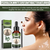 EELHOE White Spot Purifying Serum For Whitening And Repairing White Spot Spot And Perspiration Spot Skin Moisturizing Serum