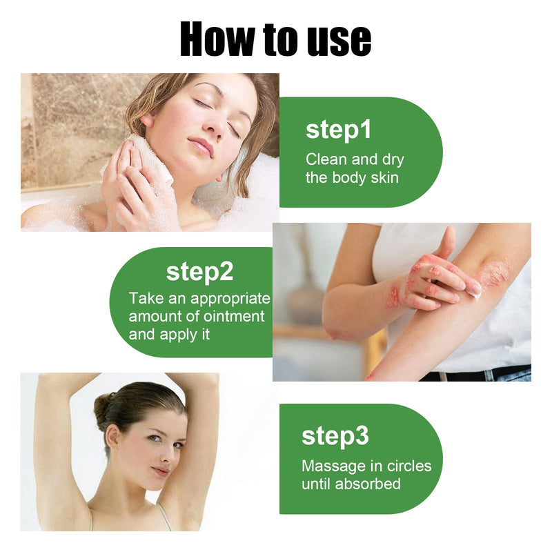 South Moon Herbal Eczema Ointment, Relieve Hand And Foot Moss Skin Redness Itchy Skin Repair Ointment