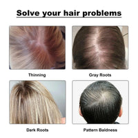 Hairline Powder, Fill In The Top Of Your Hairline With A Refreshing Fluffy Shade Powder