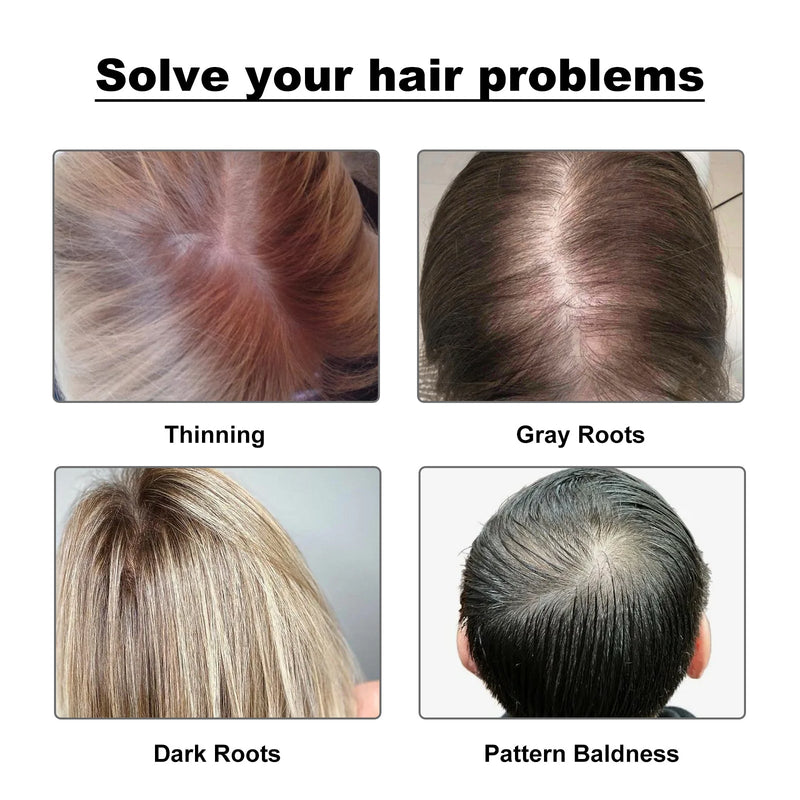 Hairline Powder, Fill In The Top Of Your Hairline With A Refreshing Fluffy Shade Powder
