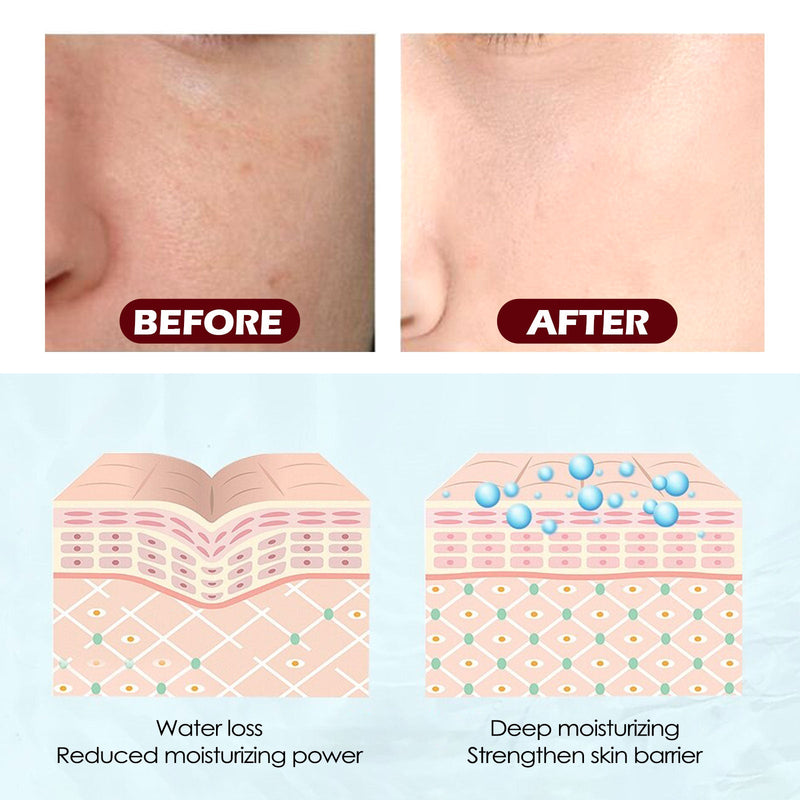 Face Gasket Hydrating, Moisturizing And Hydrating, Delicate Facial Pore Tender, Firming And Smoothing Care Gasket