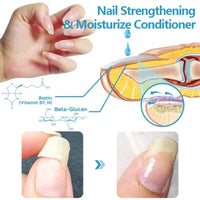 Nail Repair Solution, Repair Hands And Feet Gray Nails Rote Nails Thickening Toenails Clean And Bright Nail Care Solution