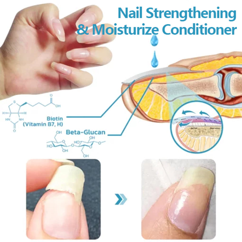 Nail Repair Solution, Repair Hands And Feet Gray Nails Rote Nails Thickening Toenails Clean And Bright Nail Care Solution