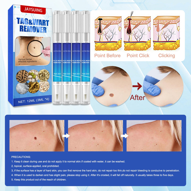 Keyo Care Pen Body Face Flesh Grain Filamentary Skin Clean And Repair Smooth Skin