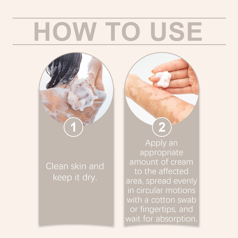 Body Care Cream, Relieve Itching And Swelling Of Hands And Feet Skin Moisturizing Skin Care Cream