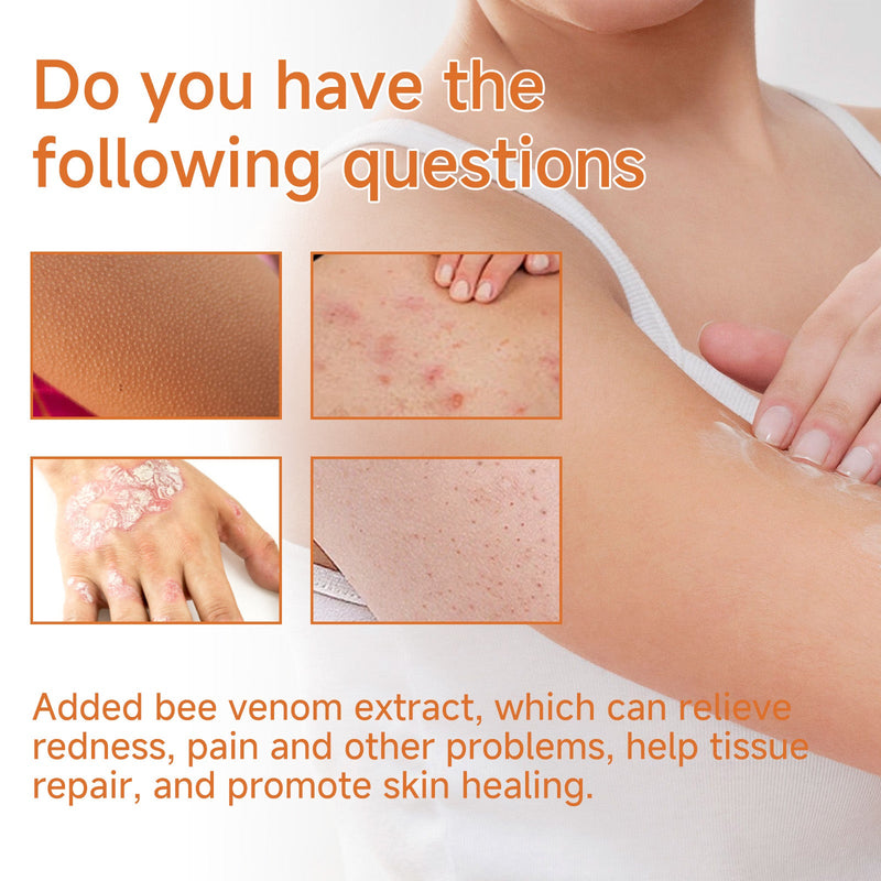 Psoriasis Behandlungscreme, Relieve Hand And Foot Skin Redness, Relieve Itching, Repair And Moisturize Skin Care