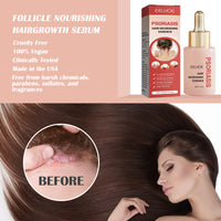 Moss Hair Nourishing Essence, Deep Cleaning Scalp, Anti-Dandruff And Itchy Refreshing Hair Care Solution