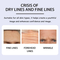 Forehead Mask, Smoothing Sichuan Character Lines And Raising Head Lines Mask Lighten Wrinkles Firming Skin Gel Forehead Patch